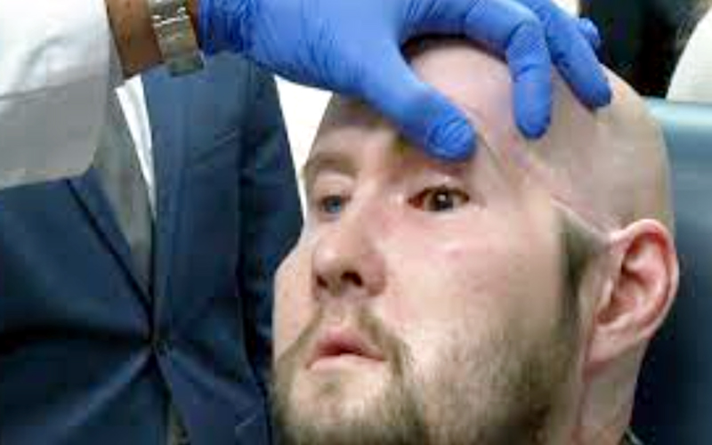 New York: A miracle in medical history.. first successful eye transplant..!